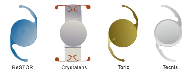 Intraocular Lens Examples