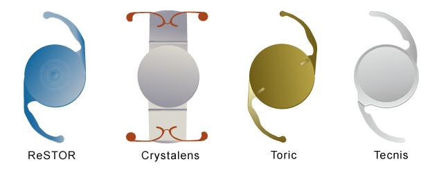 Intraocular Lens Examples